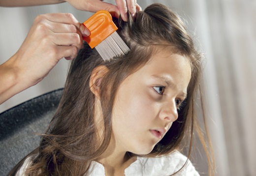 head lice prevention spray
